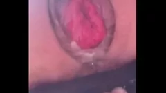 চালান শ্যামাঙ্গিনী বিয়ানকার পাবলিক বাথরুম মলদ্বার প্রল্যাপস এক্সট্রিম পিওভি